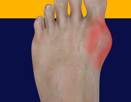 #5 for Image of a sore foot on fire (no photograph) by Xhub