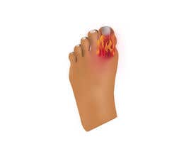 #9 Image of a sore foot on fire (no photograph) részére Sultana76 által