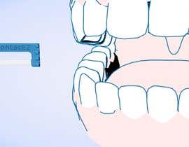 Nambari 21 ya Create an Animation for Dental Customers showing the IPR tool. na SlavaSodade