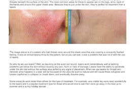 #5 cho Write an 800-word blog post titled &quot;Laser Thread Vein Removal&quot; bởi Sachin8927